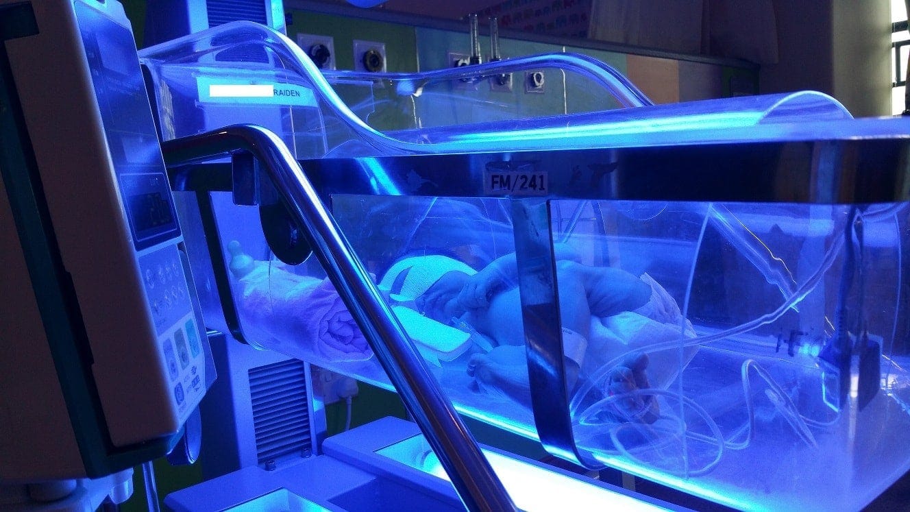 Jaundice Phototherapy